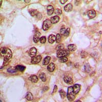 NFKB1 / NF-Kappa-B Antibody (phospho-Ser337)