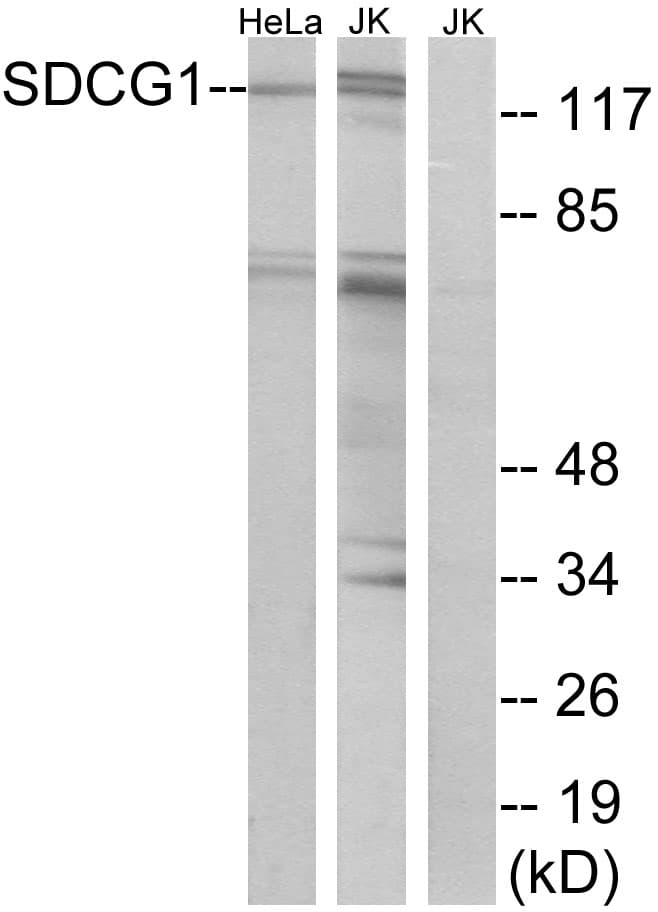 Polyclonal Rabbit anti-Human SDCCAG1 / NEMF Antibody (aa881-930, WB)