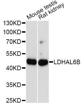 Polyclonal Rabbit anti-Human LDHAL6B Antibody (WB)
