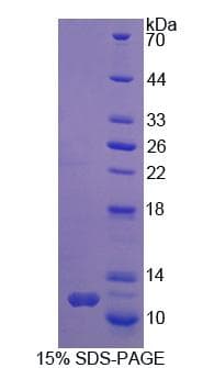 Mouse SYMPK / Symplekin Protein (Recombinant His, N-Terminal)
