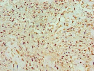 Polyclonal Rabbit anti-Human BANP Antibody (aa1-260, IHC, WB)