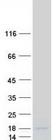 Human HIST1H2BC Protein (Recombinant Myc-DDK (Flag))
