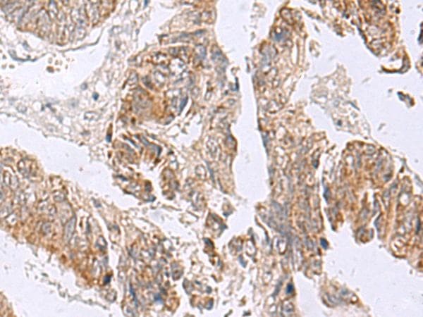 Polyclonal Rabbit anti-Human RTKN2 Antibody (IHC)