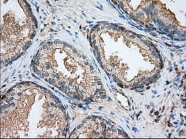 Monoclonal Mouse anti-Human ALDH3A1 Antibody (clone OTI1C6, IHC, IF, WB)