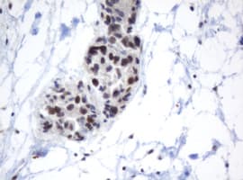 Monoclonal Mouse anti-Human METTL16 / METT10D Antibody (clone OTI3E8, IHC, WB)