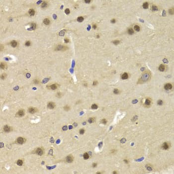 SATB1 Antibody