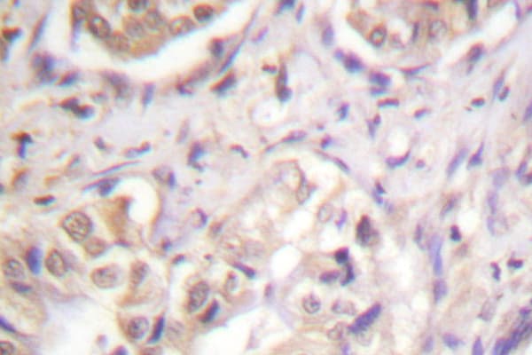 BCL2L1 / BCL-XL Antibody (Ser43)