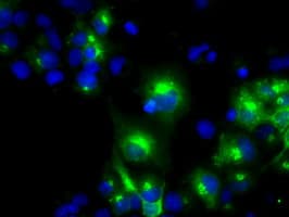 LIPG / Endothelial Lipase Antibody (clone OTI2D5)