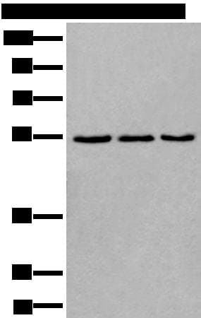 Polyclonal Rabbit anti-Human WDSUB1 Antibody (WB)