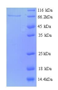 Mouse PTPRN2 / Phogrin Protein (Recombinant His)