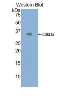 KDR / VEGFR2 / FLK1 Antibody (aa46-320)