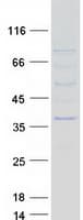 Human NMNAT2 Protein (Recombinant Myc-DDK (Flag))