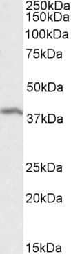 IHC-plus™ SMUG1 Antibody (aa2-14)