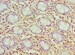 Polyclonal Rabbit anti-Human CCK / Cholecystokinin Antibody (aa21-115, IHC)