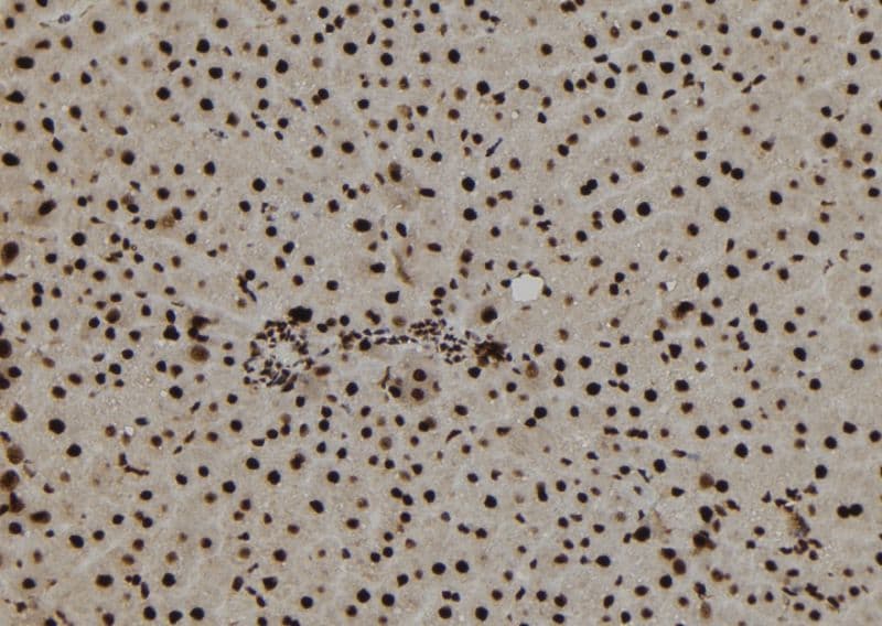 TNP1 / TP1 Antibody