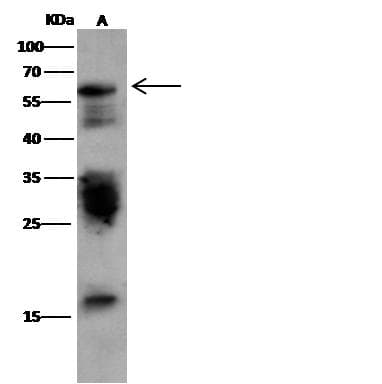 Polyclonal Rabbit anti-Human CD4 Antibody (Preservative Free, WB)
