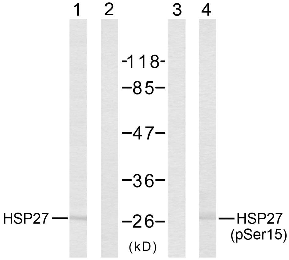HSPB1 / HSP27 Antibody (phospho-Ser15)