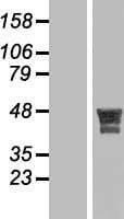 KIAA1826 Protein (Over-Expression Lysate Myc-DDK (Flag))