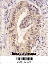 Monoclonal Mouse anti-Human ATG16L1 / ATG16L Antibody (clone 54CT27.2.6, IHC, WB)