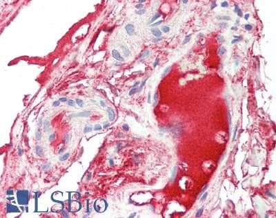 IHC-plus™ ITIH1 Antibody