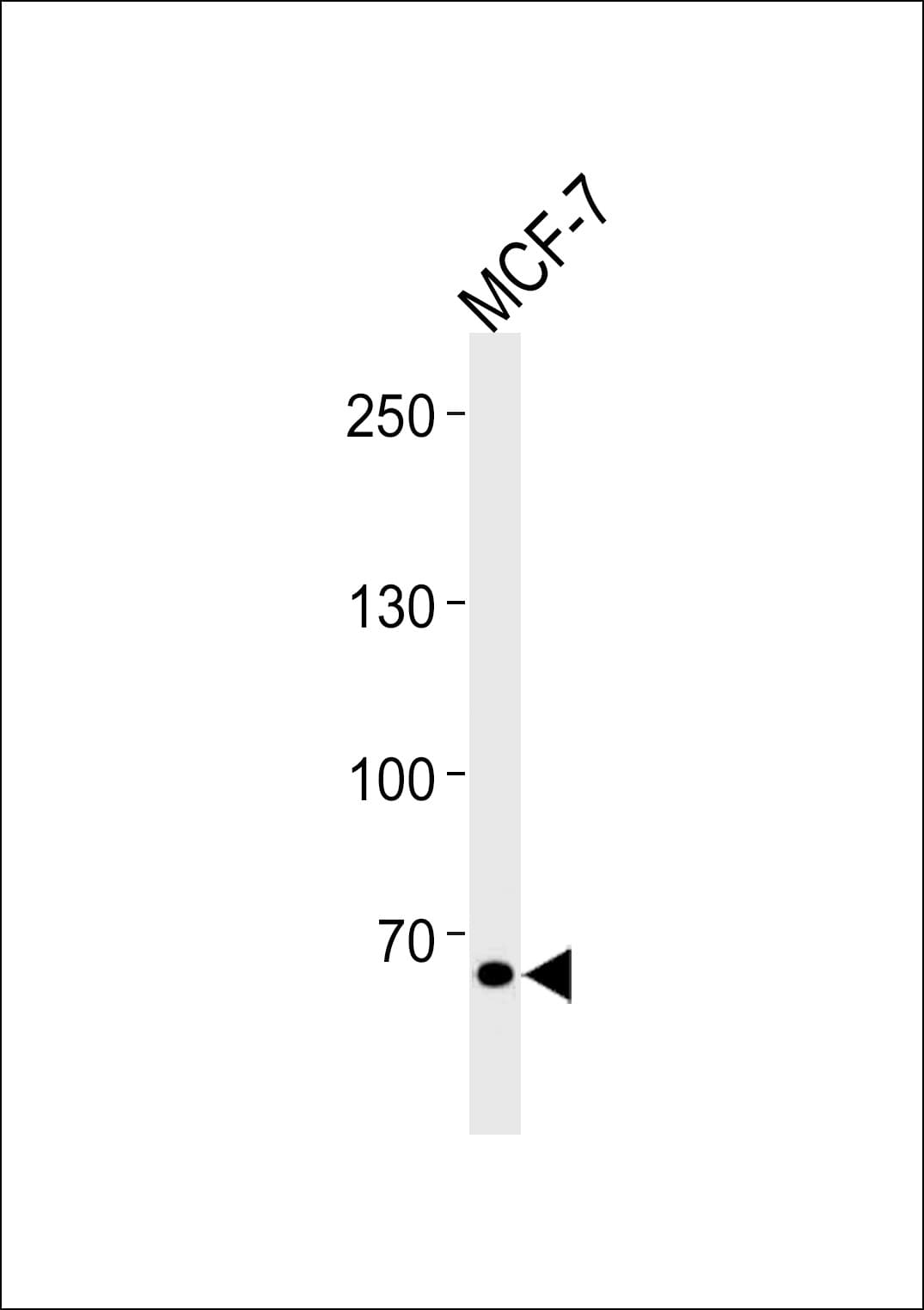 Polyclonal Rabbit anti-Human TSPYL2 / DENTT Antibody (aa380-409, WB)