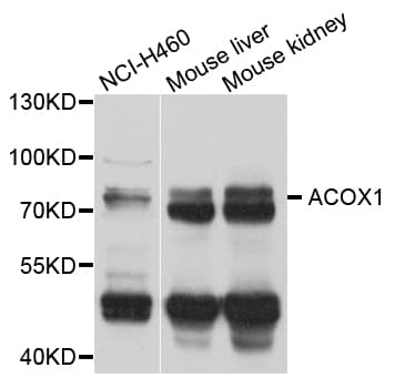Polyclonal Rabbit anti-Human ACOX1 / ACOX Antibody (IHC, WB)