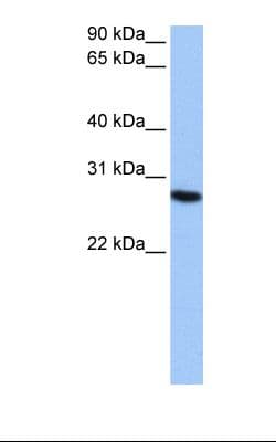 PSMA6 Antibody (aa26-75)