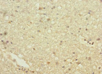 Polyclonal Rabbit anti-Human HHIP / HIP Antibody (IHC, WB)