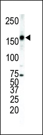Polyclonal Rabbit anti-Human ERBB4 / HER4 Antibody (aa1276-1308, IHC, WB)