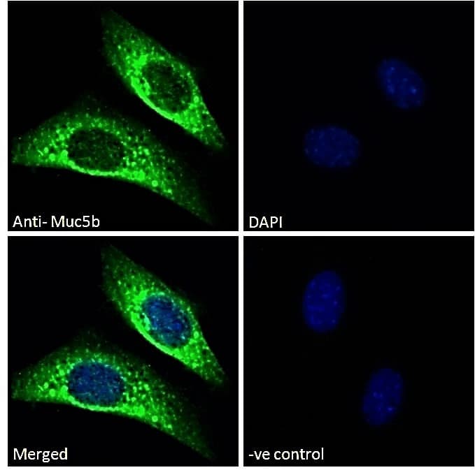 MUC5B Antibody (aa4756-4766)