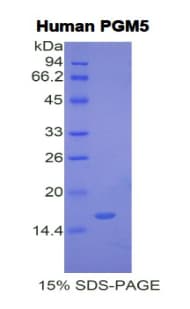 Human PGM5 / Aciculin Protein (Recombinant His)