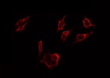 Polyclonal Rabbit anti-Human ER Alpha / Estrogen Receptor Antibody (phospho-Ser167, IHC, IF, WB)