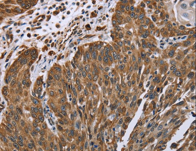 PLXNB1 / Plexin-B1 Antibody