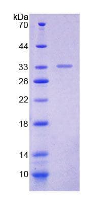 Mouse POLA1 / DNA Polymerase Alpha 1 Protein (Recombinant His-T7)