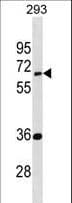 EDC3 Antibody (aa219-247)