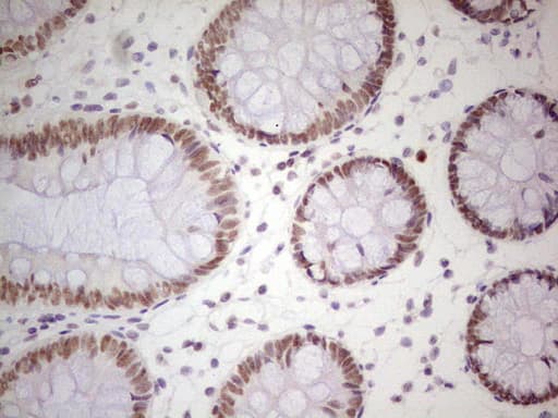 PPP1R8 / Rnase E Antibody (aa1-225, clone OTI2E12, Carrier-free)