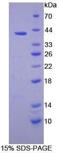 Human PSMD7 / MOV34 Protein (Recombinant His-T7)