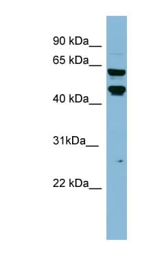 Polyclonal Rabbit anti-Human PH4 / P4HTM Antibody (aa323-372, WB)