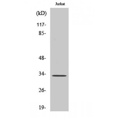 Polyclonal Rabbit anti-Human ELOVL1 Antibody (70-150 aa, Internal, WB)