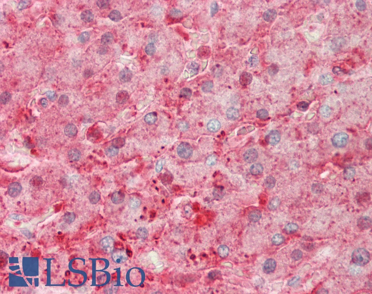 IHC-plus™ Monoclonal Mouse anti-Human SERPINA1 / Alpha 1 Antitrypsin Antibody (clone 1C2, IHC, IF, WB)