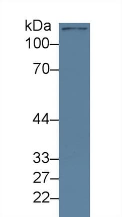 KDM4A / JHDM3A / JMJD2A Antibody (aa141-310, APC)