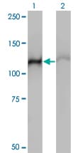 Monoclonal Mouse anti-Human HSPA4 / APG-2 Antibody (clone 3A11, WB)