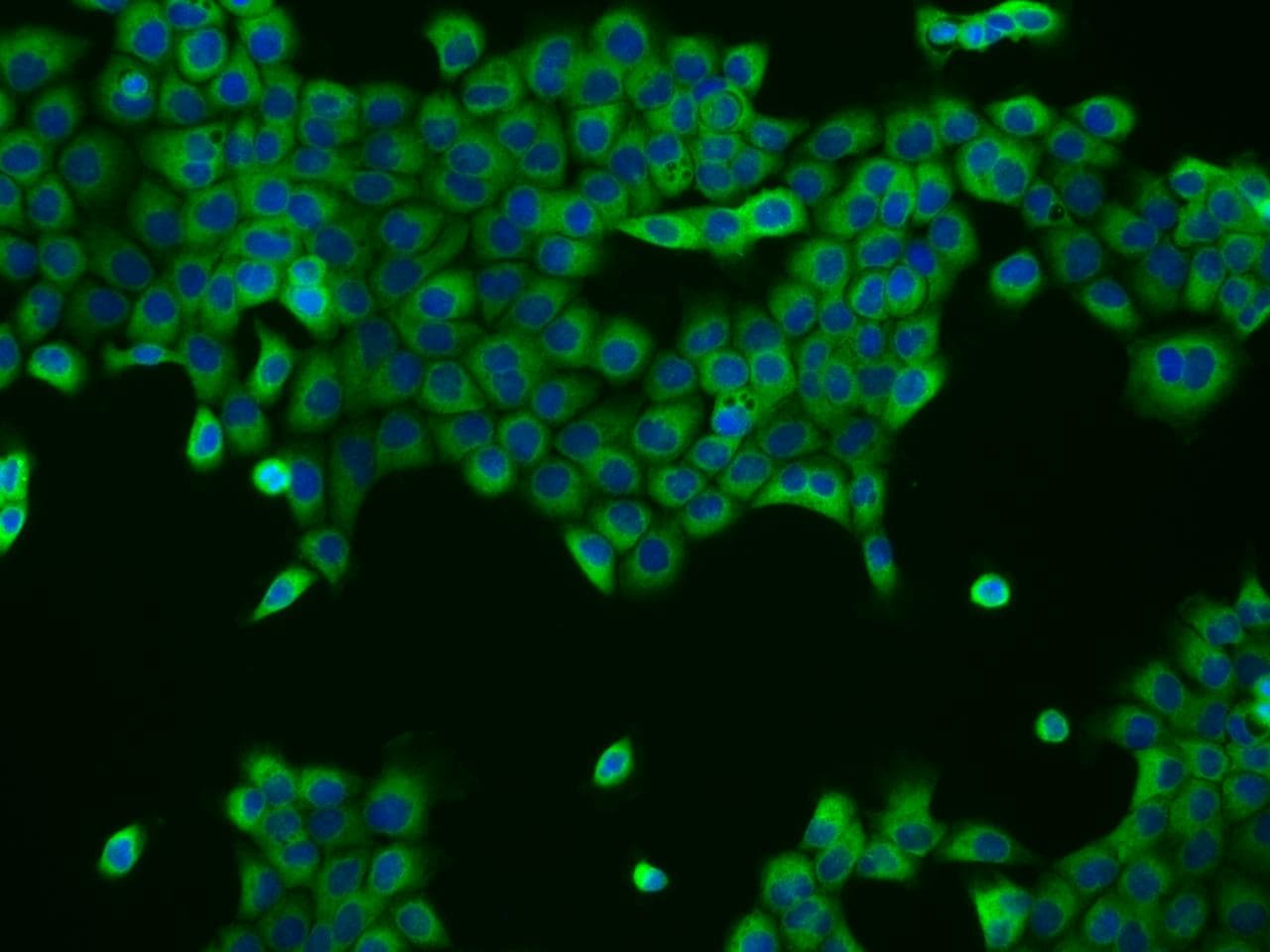 UBXD2 / UBXN4 Antibody