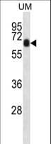 Polyclonal Rabbit anti-Human CCDC120 Antibody (aa59-88, WB)