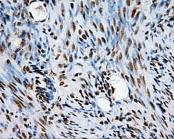 TLDC1 / KIAA1609 Antibody (clone OTI12B1)