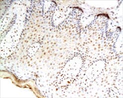 TNF Alpha Antibody