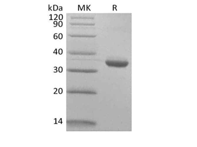 Human IgG1 Fc Protein (Recombinant AVI, C-terminus)