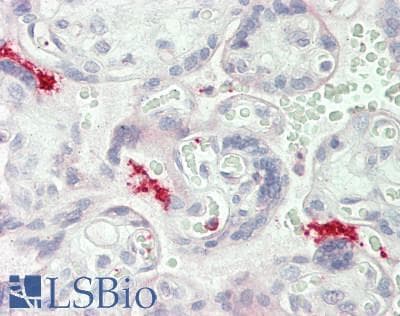 IHC-plus™ ITGB3 / Integrin Beta 3 / CD61 Antibody (aa739-788)