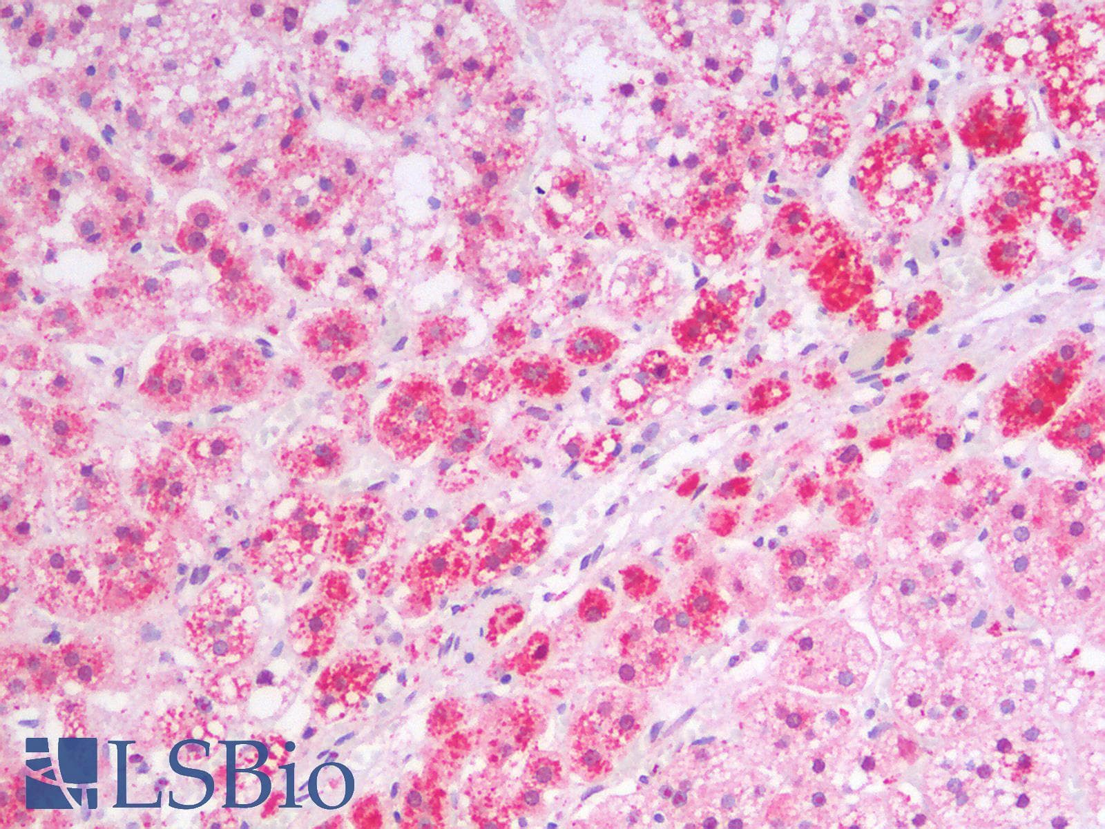 IHC-plus™ Polyclonal Goat anti-Human MSI2 Antibody (N Terminus, IHC, WB)