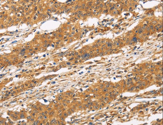 Polyclonal Rabbit anti-Human CD22 Antibody (IHC)